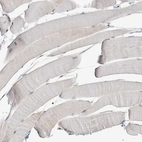 Immunohistochemical staining of human skeletal muscle shows no positivity in myocytes as expected.