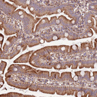 Immunohistochemical staining of human small intestine shows moderate granular cytoplasmic positivity in glandular cells.