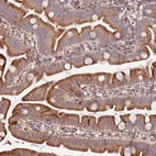 Immunohistochemical staining of human small intestine shows moderate granular cytoplasmic positivity in glandular cells.