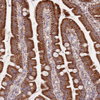 Anti-DOCK6 Antibody