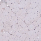 Immunohistochemical staining of human skeletal muscle shows no positivity in myocytes as expected.