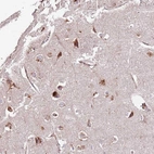 Immunohistochemical staining of human cerebral cortex shows strong granular cytoplasmic positivity in neuronal cells.