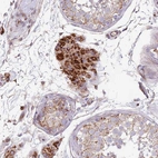 Immunohistochemical staining of human testis shows strong granular cytoplasmic positivity in Leydig cells.