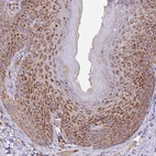 Immunohistochemical staining of human skin shows strong granular cytoplasmic positivity in squamous epithelial cells.