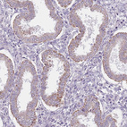 Anti-SMPD4 Antibody