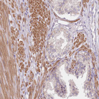 Immunohistochemical staining of human prostate shows strong cytoplasmic positivity in smooth muscle cells.