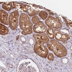 Immunohistochemical staining of human kidney shows strong cytoplasmic positivity in cells in tubules.