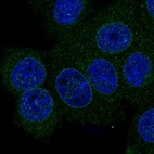 Anti-SMPD4 Antibody