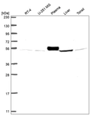 Western blot analysis in human cell line RT-4, human cell line U-251 MG, human plasma, human liver tissue and human tonsil tissue.