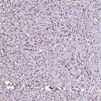Anti-NOB1 Antibody
