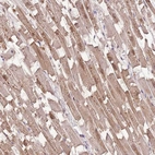 Immunohistochemical staining of human heart muscle shows moderate cytoplasmic positivity in cardiomyocytes.