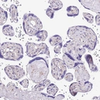 Immunohistochemical staining of human placenta shows no cytoplasmic positivity in trophoblastic cells as expected.