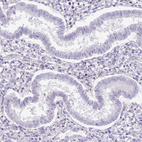 Immunohistochemical staining of human endometrium shows no positivity in glandular cells as expected.