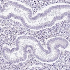 Immunohistochemical staining of human endometrium shows no positivity in glandular cells as expected.