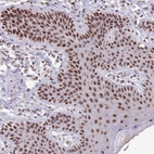 Immunohistochemical staining of human skin shows strong nuclear positivity in squamous epithelial cells.