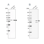 Western blot analysis using Anti-SF3A2 antibody HPA049439 (A) shows similar pattern to independent antibody HPA042843 (B).