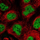 Immunofluorescent staining of human cell line HEK 293 shows localization to nucleoplasm.