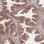 Anti-CFAP97 Antibody