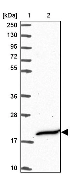 Lane 1: Marker [kDa] 250, 130, 95, 72, 55, 36, 28, 17, 10_br/_Lane 2: Human cell line RT-4