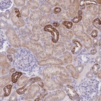 Anti-NBEAL1 Antibody