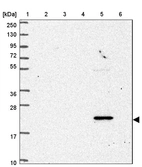 Lane 1: Marker [kDa] 250, 130, 95, 72, 55, 36, 28, 17, 10_br/_Lane 2: Human cell line RT-4_br/_Lane 3: Human cell line U-251MG sp_br/_Lane 4: Human plasma (IgG/HSA depleted)_br/_Lane 5: Human liver tissue_br/_Lane 6: Human tonsil tissue