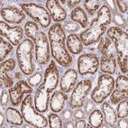 Anti-SLC25A42 Antibody