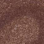 Anti-RAVER1 Antibody