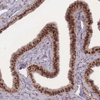 Immunohistochemical staining of human Fallopian tube shows strong nuclear positivity in glandular cells.