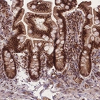 Immunohistochemical staining of human small intestine shows strong nuclear positivity in glandular cells.
