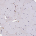 Immunohistochemical staining of human skeletal muscle shows low positivity in myocytes as expected.