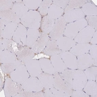 Immunohistochemical staining of human skeletal muscle shows low positivity in myocytes as expected.