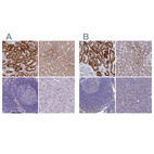 Immunohistochemical staining of human kidney, liver, lymph node and pancreas using Anti-AK4 antibody HPA049461 (A) shows similar protein distribution across tissues to independent antibody HPA042753 (B).