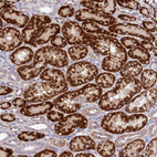 Immunohistochemical staining of human kidney shows strong granular cytoplasmic positivity in cells in tubules.