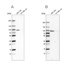 Western blot analysis using Anti-RAVER1 antibody HPA049457 (A) shows similar pattern to independent antibody HPA043575 (B).