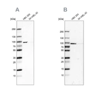 Western blot analysis using Anti-RAVER1 antibody HPA049457 (A) shows similar pattern to independent antibody HPA043575 (B).