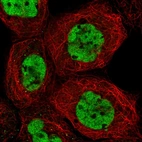 Immunofluorescent staining of human cell line A-431 shows localization to nucleoplasm.