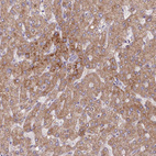 Immunohistochemical staining of human liver shows moderate granular cytoplasmic positivity in hepatocytes.