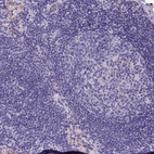 Immunohistochemical staining of human lymph node shows no positivity in germinal center cells as expected.