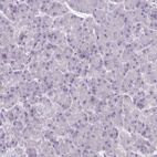 Immunohistochemical staining of human pancreas shows no positivity in exocrine glandular cells as expected.
