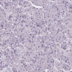 Immunohistochemical staining of human pancreas shows no positivity in exocrine glandular cells as expected.