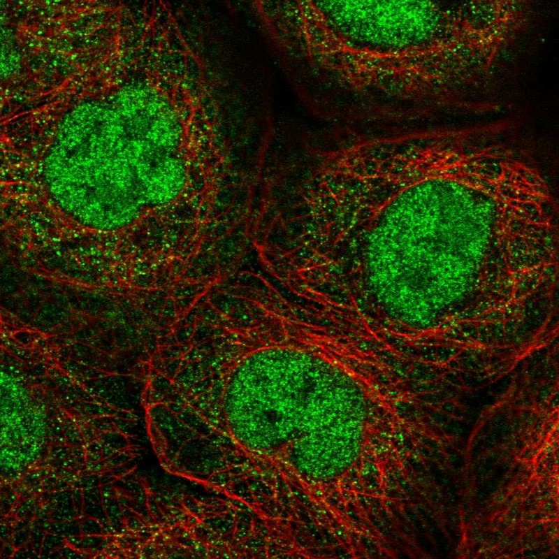 Anti-ANKRD11 Antibody