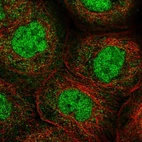 Anti-ANKRD11 Antibody