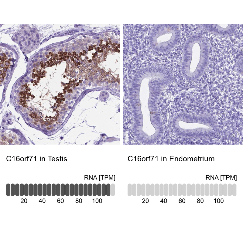 Anti-C16orf71 Antibody