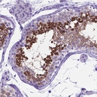 Immunohistochemical staining of human testis shows high expression.