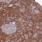 Anti-DAND5 Antibody