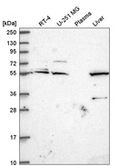 Anti-IRF2BP1 Antibody
