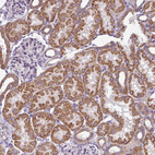 Immunohistochemical staining of human kidney shows strong granular cytoplasmic positivity in cells in tubules.