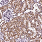 Immunohistochemical staining of human kidney shows strong granular cytoplasmic positivity in cells in tubules.