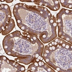 Immunohistochemical staining of human small intestine shows strong cytoplasmic positivity in glandular cells.