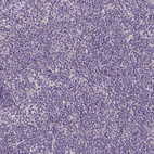Immunohistochemical staining of human lymph node shows no positivity in non-germinal center cells as expected.